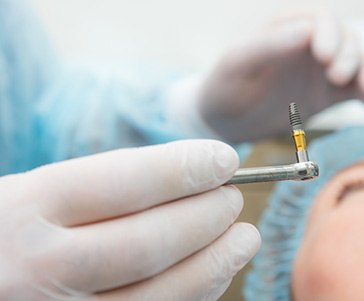 The next step is dental implant surgery, where your dental implants are placed in the jaw