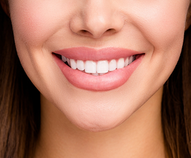 Close-up of a woman's smile after full mouth reconstruction
